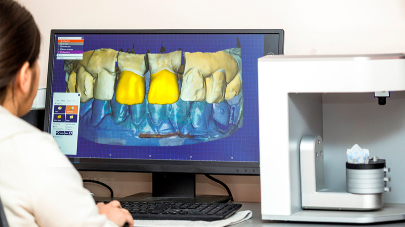 CAD / CAM full digital denture design center