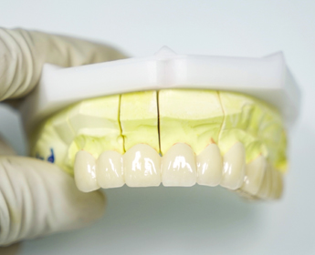 Korean Hanyu zirconia all ceramic