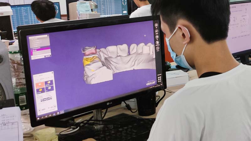 CAD/CAM全数字化义齿设计中心